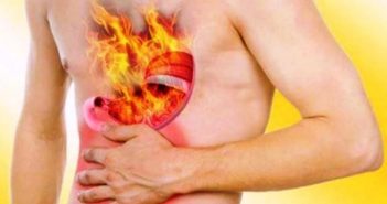 ग्याष्ट्रिक भएका मानिसले अपनाउनुपर्ने सावधानीहरू