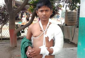 शिक्षकको कुटाईबाट बालकको हात भाँचियो